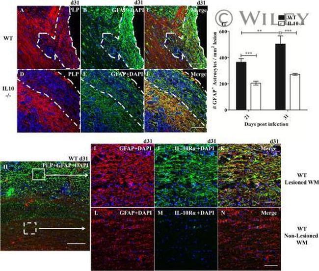 CD3 Antibody in Immunohistochemistry (IHC)