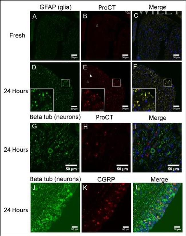 GFAP Antibody in Immunohistochemistry (IHC)