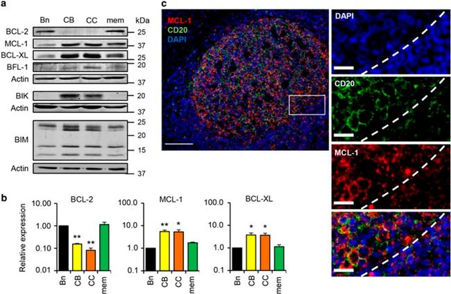 CD20 Antibody in Immunohistochemistry (IHC)