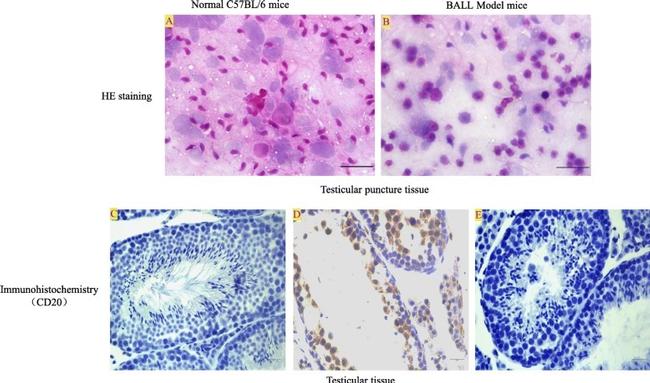 CD20 Antibody in Immunohistochemistry (IHC)