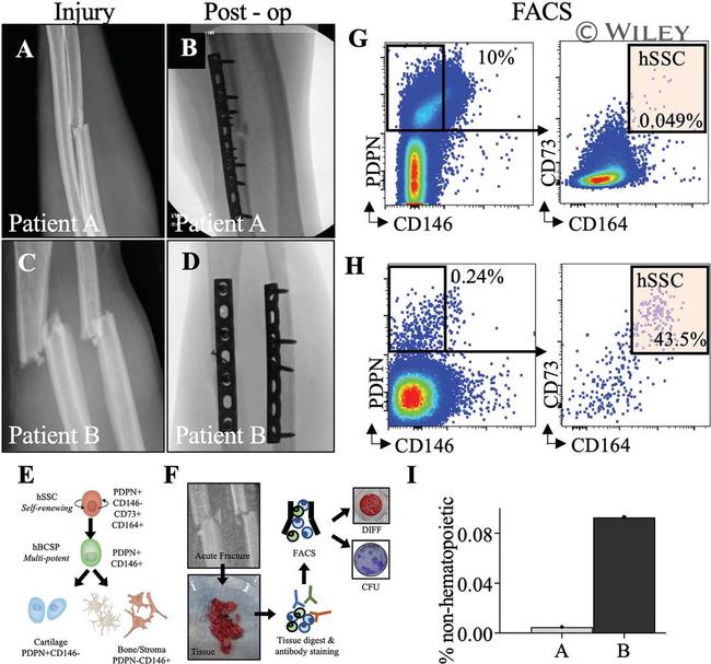 Podoplanin Antibody in Flow Cytometry (Flow)