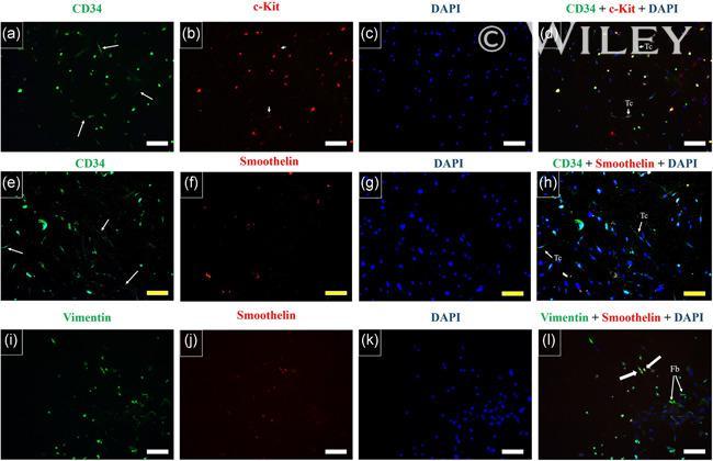 CD34 Antibody in Immunocytochemistry (ICC/IF)