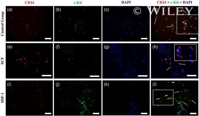 CD117 (c-Kit) Antibody in Immunocytochemistry (ICC/IF)