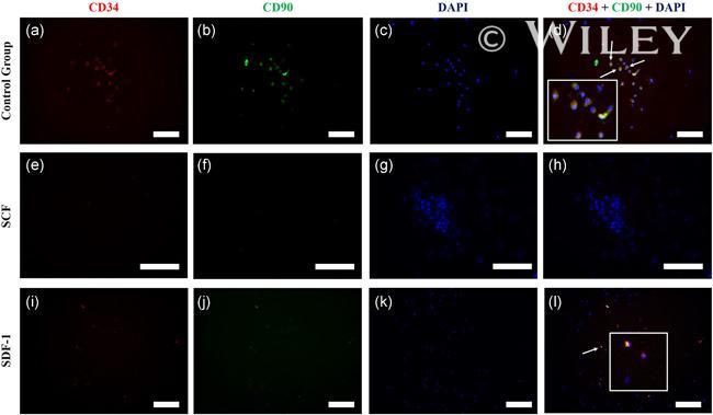 CD34 Antibody in Immunocytochemistry (ICC/IF)