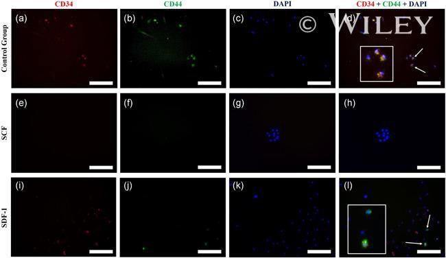 CD44 Antibody in Immunocytochemistry (ICC/IF)