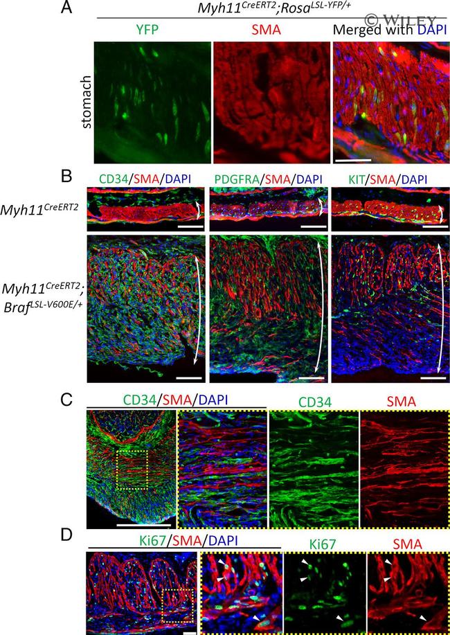 CD140a (PDGFRA) Antibody in Immunohistochemistry (IHC)