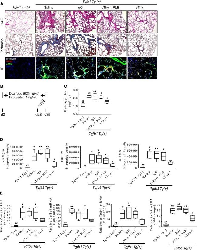 CD51 (Integrin alpha V) Antibody in Immunohistochemistry (IHC)