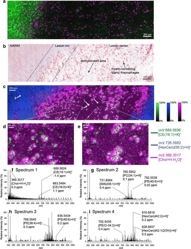 CD68 Antibody in Immunohistochemistry (IHC)