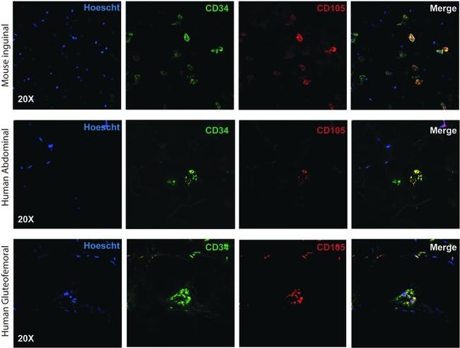 CD105 (Endoglin) Antibody in Immunocytochemistry (ICC/IF)