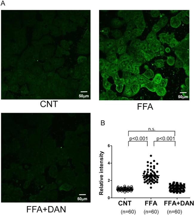 CD106 (VCAM-1) Antibody in Immunohistochemistry (IHC)