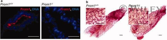 CD133 (Prominin-1) Antibody in Immunohistochemistry (IHC)