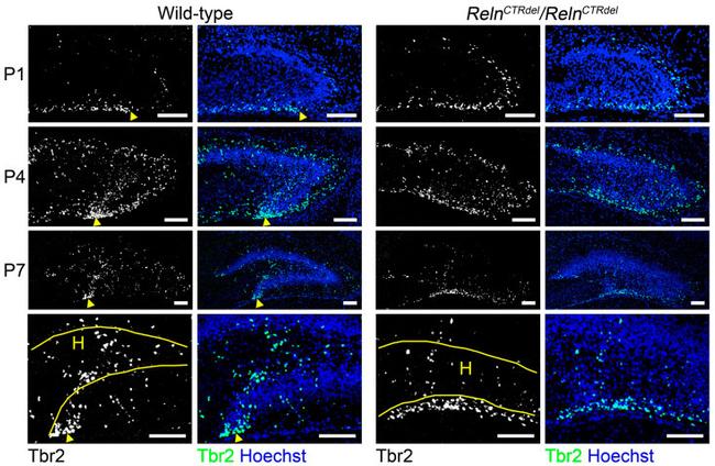 EOMES Antibody in Immunohistochemistry (IHC)