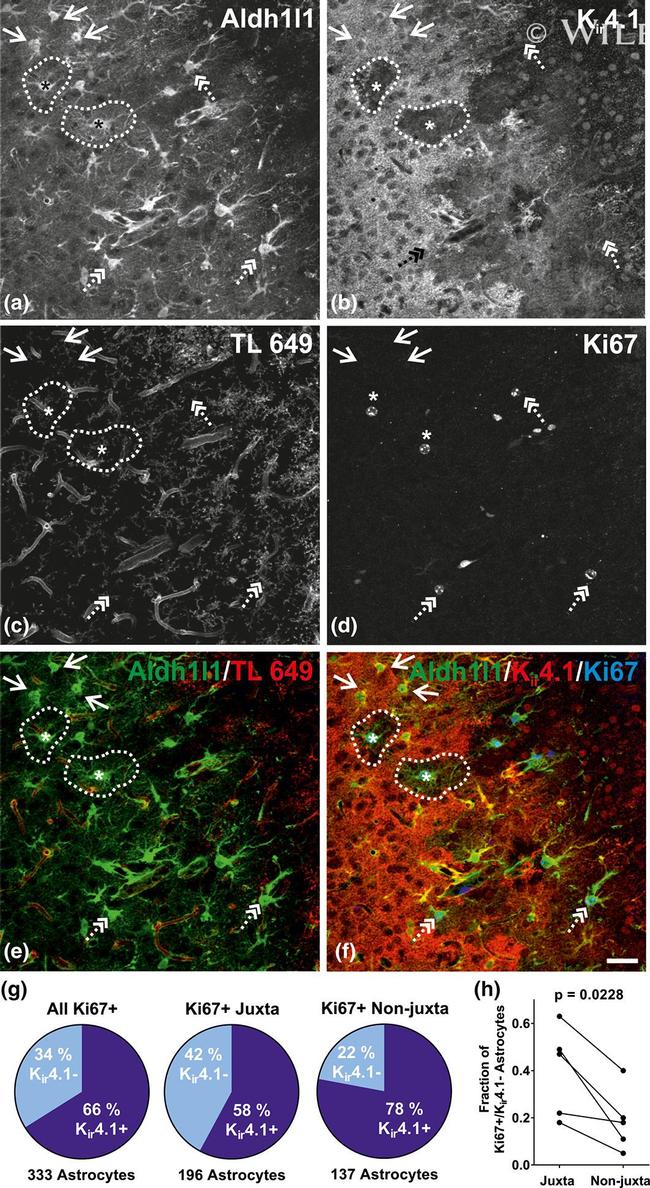 Ki-67 Antibody in Immunocytochemistry, Immunohistochemistry (ICC/IF, IHC)