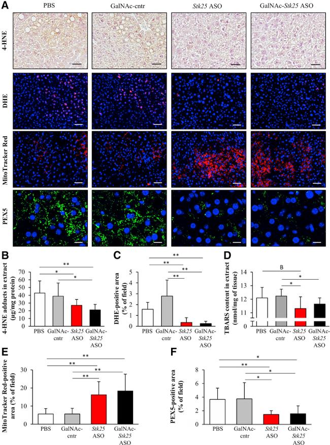 PEX5 Antibody in Immunohistochemistry (IHC)