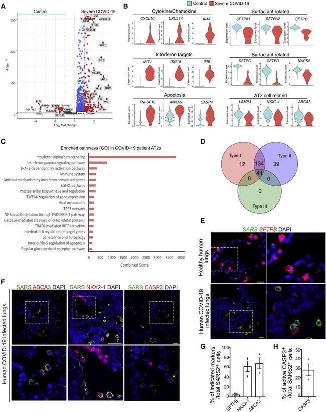 SARS Coronavirus Nucleocapsid Antibody in Immunohistochemistry (IHC)