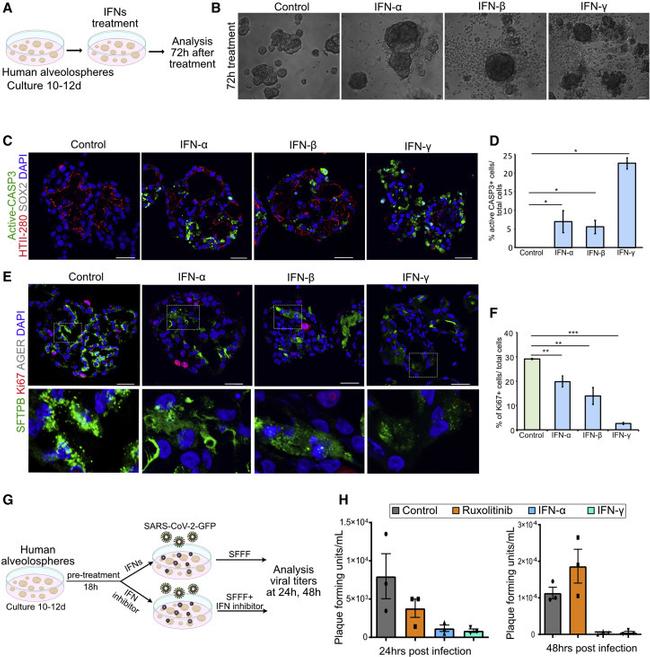 SFTPB Antibody in Immunohistochemistry (IHC)