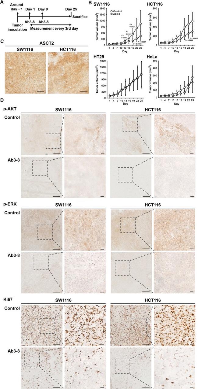 Ki-67 Antibody in Immunohistochemistry (IHC)