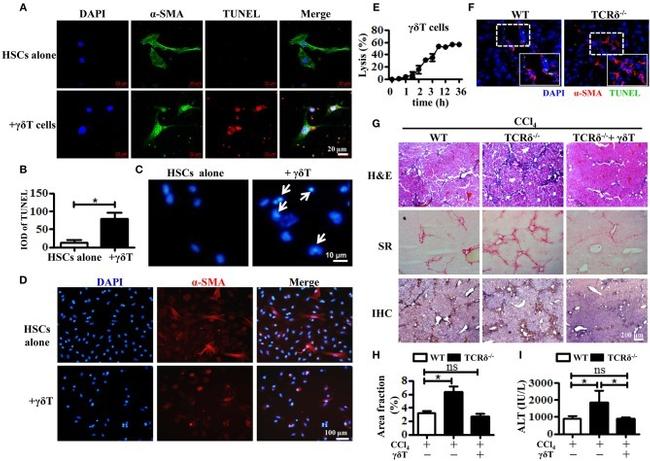 TCR gamma/delta Antibody in Immunocytochemistry (ICC/IF)