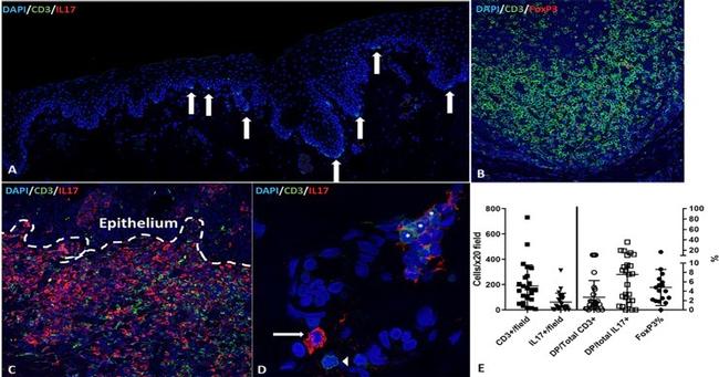 FOXP3 Antibody in Immunocytochemistry (ICC/IF)