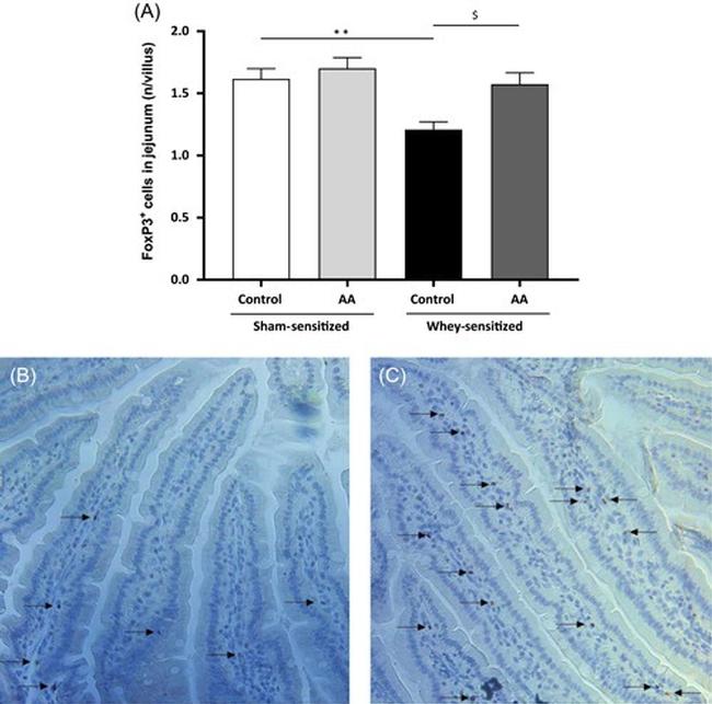 FOXP3 Antibody in Immunohistochemistry (IHC)