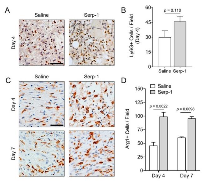 Ly-6G/Ly-6C Antibody in Immunohistochemistry (IHC)