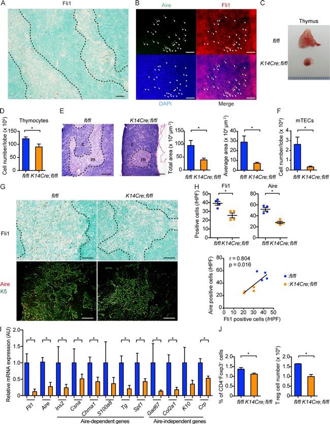 AIRE Antibody in Immunocytochemistry, Immunohistochemistry (ICC/IF, IHC)