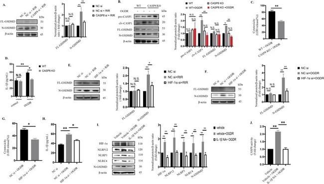 IL-1 beta Antibody in Neutralization (Neu)