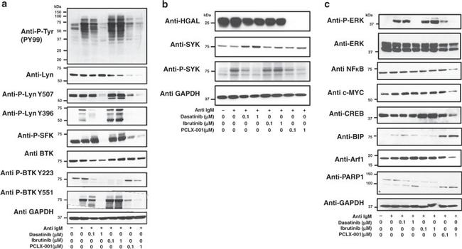 HGAL Antibody in Western Blot (WB)