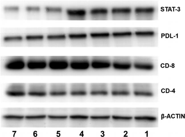 CD4 Antibody in Western Blot (WB)