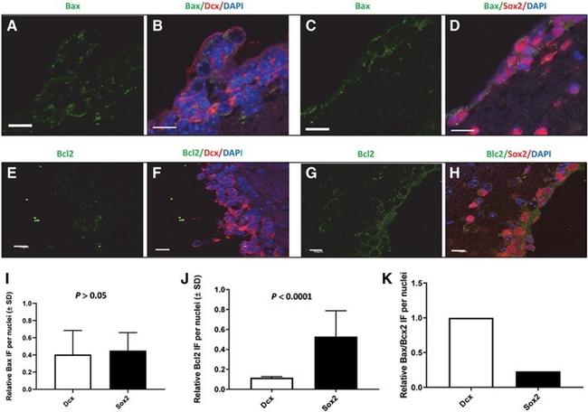 SOX2 Antibody in Immunocytochemistry (ICC/IF)