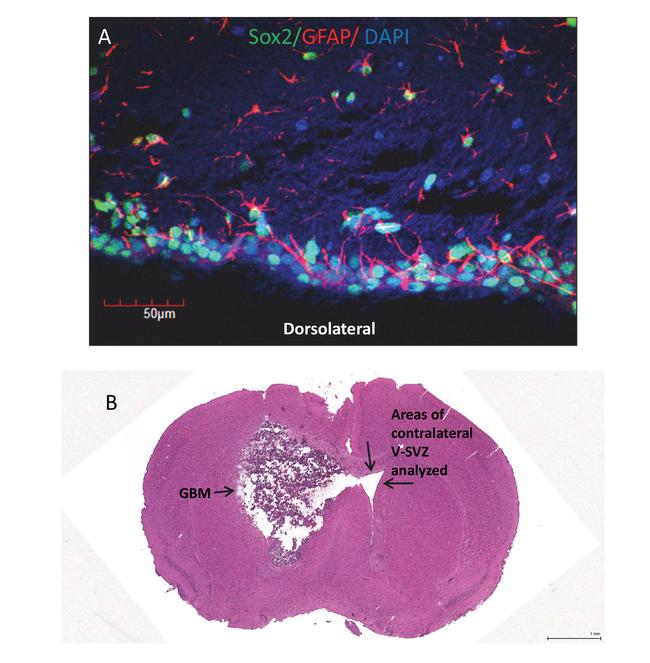 SOX2 Antibody in Immunocytochemistry (ICC/IF)