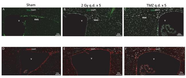 SOX2 Antibody in Immunocytochemistry (ICC/IF)