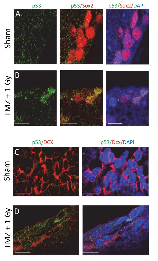 SOX2 Antibody in Immunocytochemistry (ICC/IF)