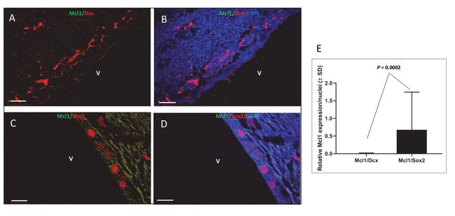 SOX2 Antibody in Immunocytochemistry (ICC/IF)