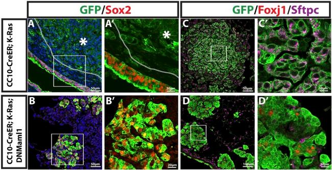 FOXJ1 Antibody in Immunohistochemistry (IHC)