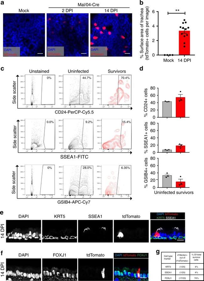 FOXJ1 Antibody in Immunohistochemistry (IHC)