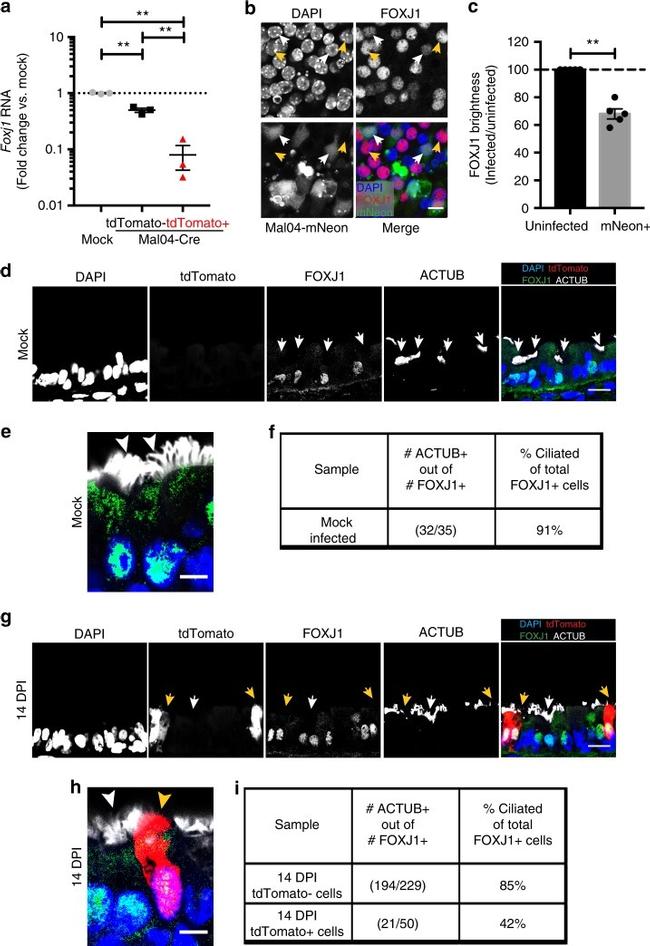 FOXJ1 Antibody in Immunohistochemistry (IHC)