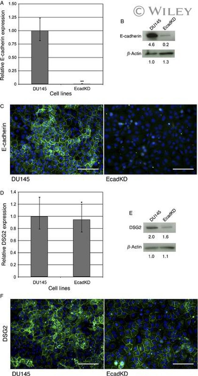 GFAP Antibody in Immunocytochemistry (ICC/IF)