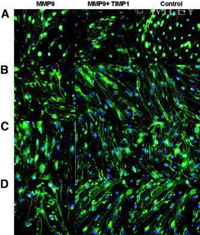 PLK1 Antibody in Immunocytochemistry (ICC/IF)