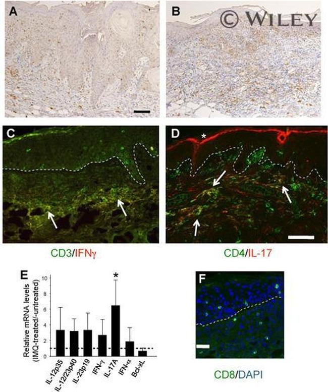 IFN gamma Antibody in Immunohistochemistry (IHC)