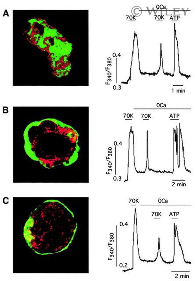 SERCA2 ATPase Antibody in Immunocytochemistry (ICC/IF)