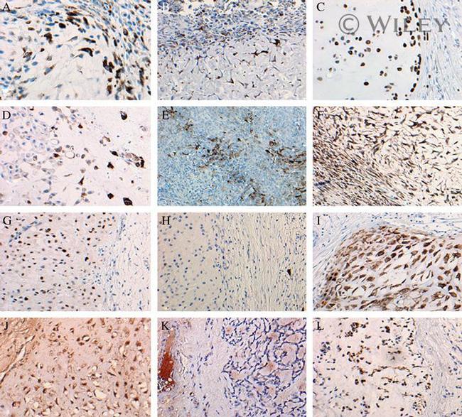 COX2 Antibody in Immunohistochemistry, Immunohistochemistry (Paraffin) (IHC, IHC (P))