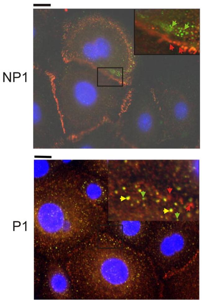 Desmoglein 3 Antibody in Immunocytochemistry (ICC/IF)