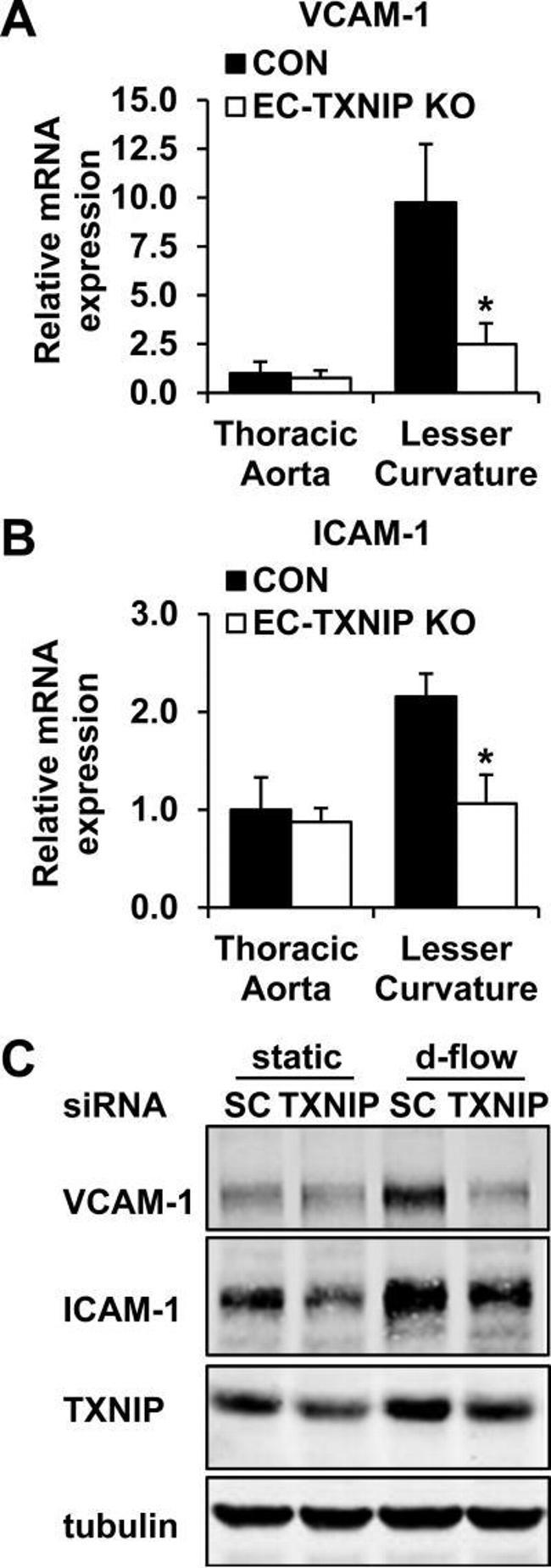 TXNIP Antibody in Western Blot (WB)