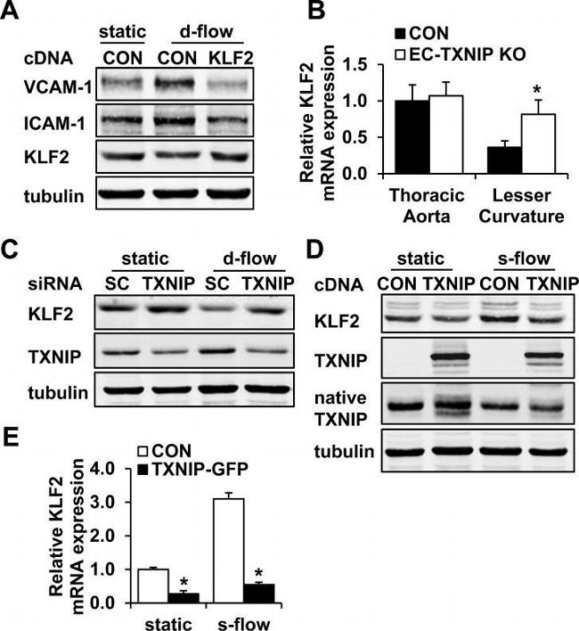 TXNIP Antibody in Western Blot (WB)