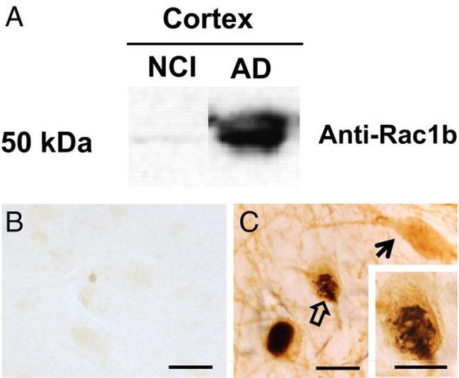 NGFR Antibody in Immunohistochemistry (IHC)