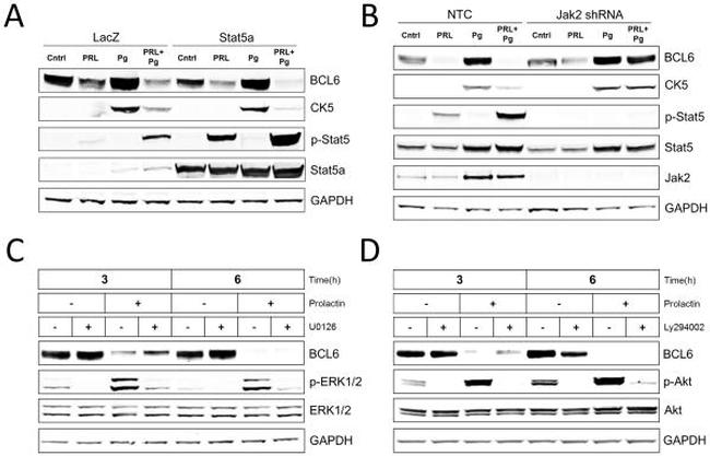 Cytokeratin 5 Antibody in Western Blot (WB)