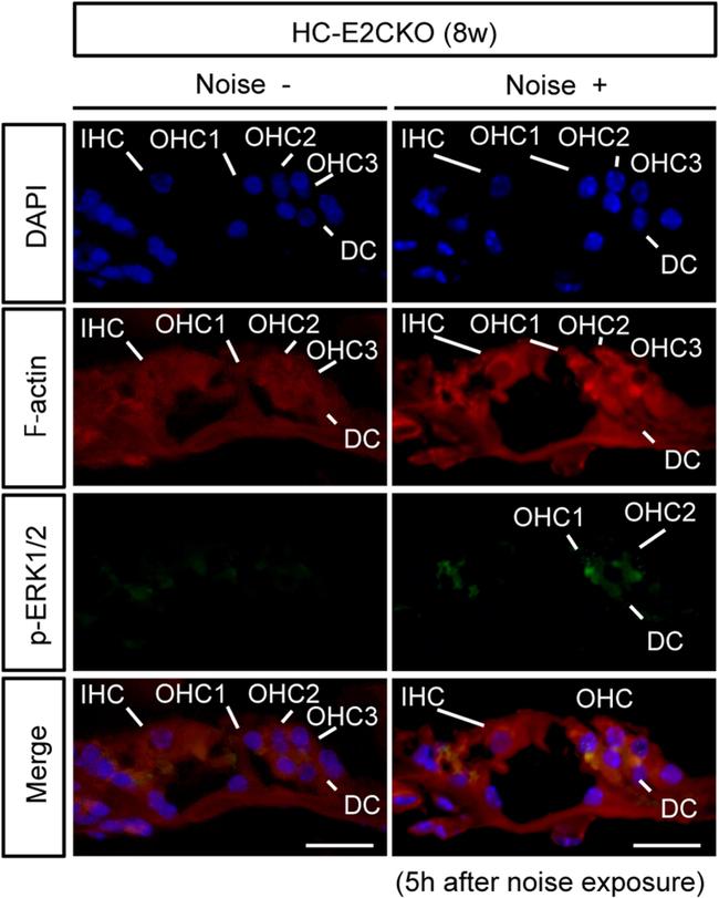 ERK1 Antibody in Immunohistochemistry (IHC)