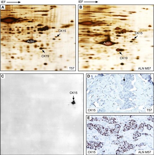 Cytokeratin 15 Antibody in Immunohistochemistry (IHC)