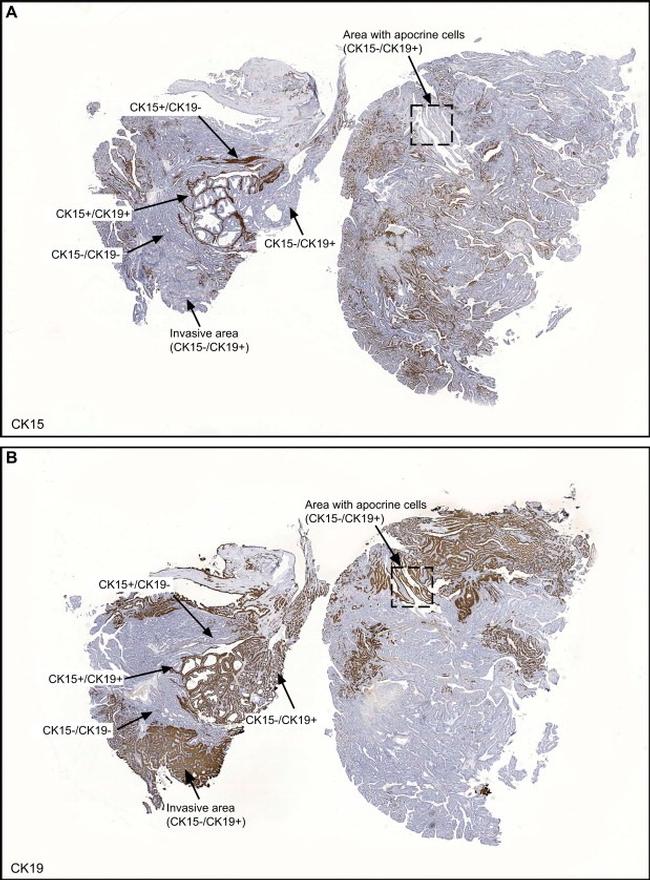 Cytokeratin 15 Antibody in Immunohistochemistry (Paraffin) (IHC (P))